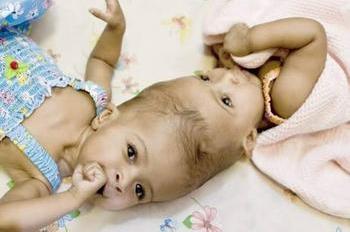 Twins as babies.jpg